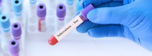 Doctor holding a test blood sample tube with Tuberculosis test on the background of medical test tubes with analyzes. Banner