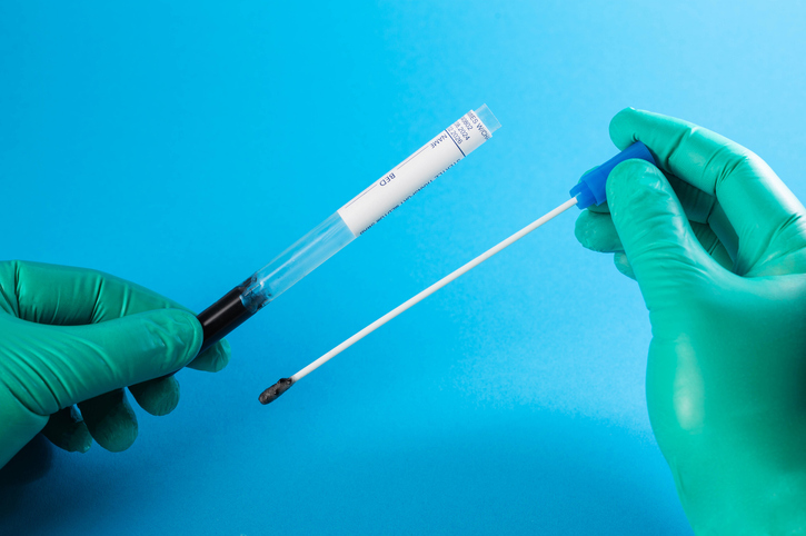 Doctor's hands in green medical gloves hold a sterile smear on a blue background for antibodies to chickenpox and meningitis. Rabies dog bite antibodies. Copy space for text