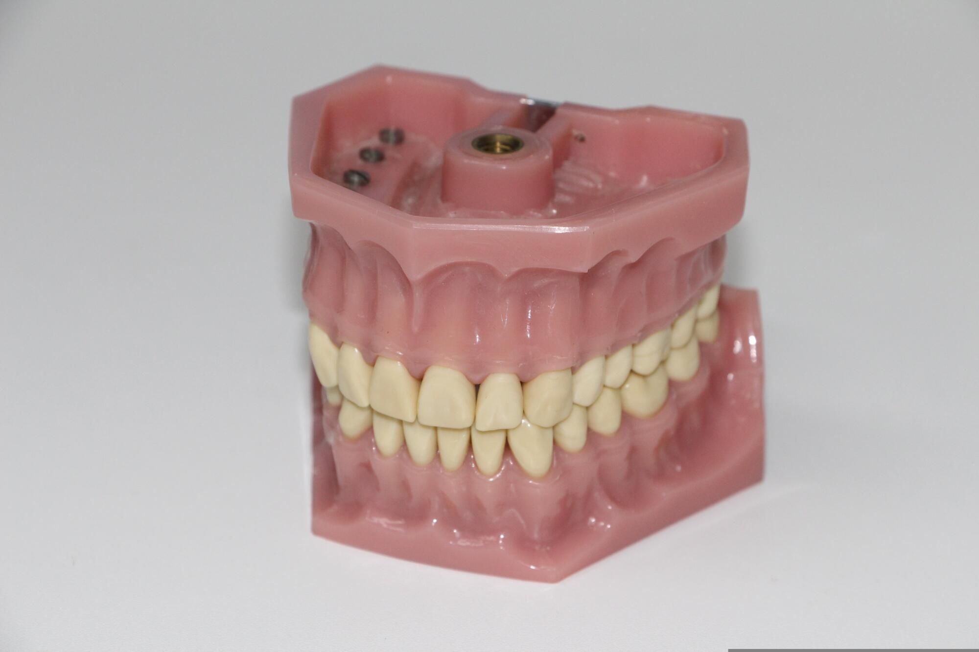 Say goodbye to stained teeth: Better options than store kits